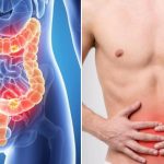7 Langkah Mengurangi Risiko Penyakit Usus