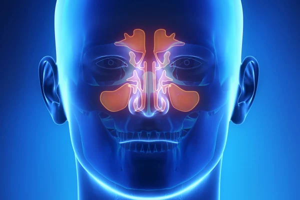 7 Cara Mengetahui Apakah Anda Mengalami Radang Hidung 7 Cara Mengetahui Apakah Anda Mengalami Radang Hidung