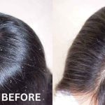 10 Tips Rambut Bebas Ketombe dan Tetap Lembut