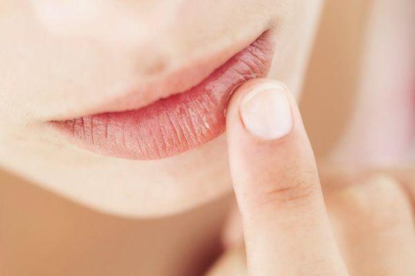 7 Kebiasaan yang Harus Dihindari Biar Bibir Gak Pecah-Pecah 7 Kebiasaan yang Harus Dihindari Biar Bibir Gak Pecah-Pecah